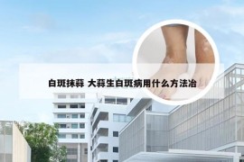 白斑抹蒜 大蒜生白斑病用什么方法冶