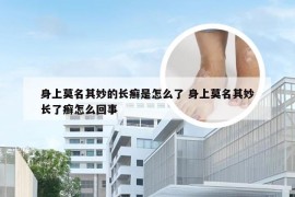 身上莫名其妙的长癣是怎么了 身上莫名其妙长了癣怎么回事