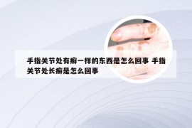 手指关节处有癣一样的东西是怎么回事 手指关节处长癣是怎么回事