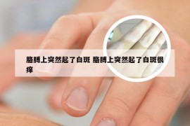 胳膊上突然起了白斑 胳膊上突然起了白斑很痒