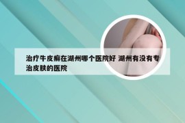 治疗牛皮癣在湖州哪个医院好 湖州有没有专治皮肤的医院