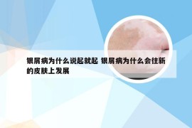 银屑病为什么说起就起 银屑病为什么会往新的皮肤上发展