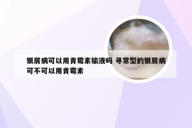 银屑病可以用青霉素输液吗 寻常型的银屑病可不可以用青霉素