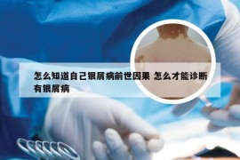 怎么知道自己银屑病前世因果 怎么才能诊断有银屑病