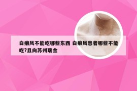 白癞风不能吃哪些东西 白癞风患者哪些不能吃?且向苏州瑞金