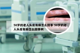 50岁的老人头皮有癣怎么回事 50岁的老人头皮有癣怎么回事啊