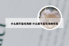 什么癣不能吃海鲜 什么癣不能吃海鲜和鱼