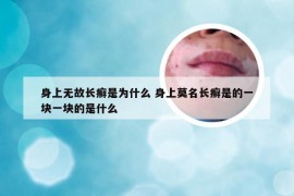 身上无故长癣是为什么 身上莫名长癣是的一块一块的是什么