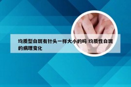 均质型白斑有针头一样大小的吗 均质性白斑的病理变化