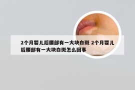 2个月婴儿后腰部有一大块白斑 2个月婴儿后腰部有一大块白斑怎么回事