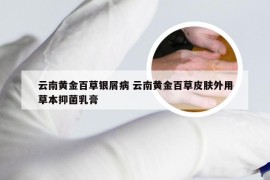 云南黄金百草银屑病 云南黄金百草皮肤外用草本抑菌乳膏