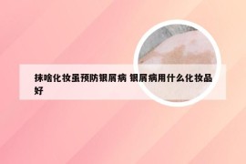 抹啥化妆虽预防银屑病 银屑病用什么化妆品好