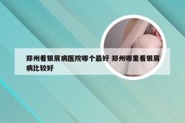 郑州看银屑病医院哪个最好 郑州哪里看银屑病比较好