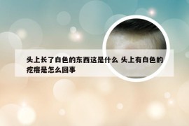 头上长了白色的东西这是什么 头上有白色的疙瘩是怎么回事