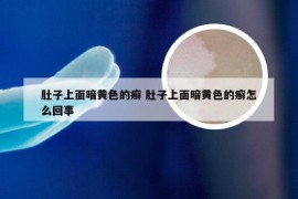 肚子上面暗黄色的癣 肚子上面暗黄色的癣怎么回事