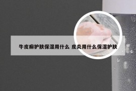 牛皮癣护肤保湿用什么 皮炎用什么保湿护肤