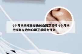 6个月抱抱嘴角左边长白斑正常吗 6个月抱抱嘴角左边长白斑正常吗为什么