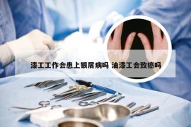 漆工工作会患上银屑病吗 油漆工会致癌吗