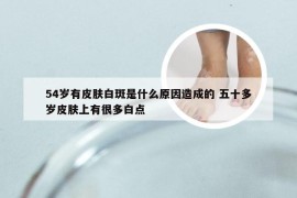 54岁有皮肤白斑是什么原因造成的 五十多岁皮肤上有很多白点