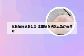 掌指脓包病怎么治 掌指脓包病怎么治疗效果好