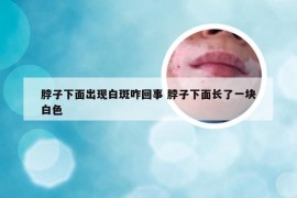 脖子下面出现白斑咋回事 脖子下面长了一块白色