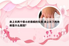 身上长两个很小的像癣的东西 身上长了两块癣是什么原因?