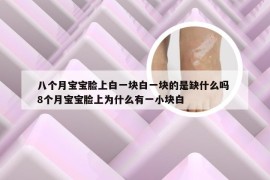 八个月宝宝脸上白一块白一块的是缺什么吗 8个月宝宝脸上为什么有一小块白