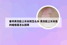 春天男生脸上长白斑怎么办 男生脸上长白色的痘痘是怎么回事