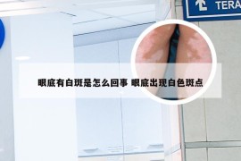 眼底有白斑是怎么回事 眼底出现白色斑点