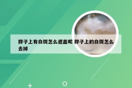 脖子上有白斑怎么遮盖呢 脖子上的白斑怎么去掉