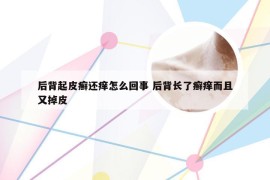 后背起皮癣还痒怎么回事 后背长了癣痒而且又掉皮