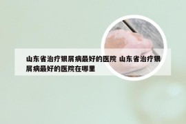 山东省治疗银屑病最好的医院 山东省治疗银屑病最好的医院在哪里