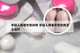 年轻人得老年性白斑 年轻人得老年性白斑怎么治疗