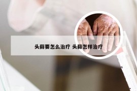 头藓要怎么治疗 头藓怎样治疗