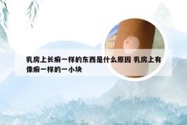 乳房上长癣一样的东西是什么原因 乳房上有像癣一样的一小块