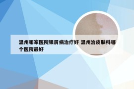 温州哪家医院银屑病治疗好 温州治皮肤科哪个医院最好