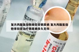 复方丙酸氯倍他索软膏银屑病 复方丙酸氯倍他索软膏治疗银屑病多久见效