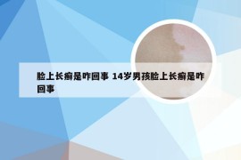 脸上长癣是咋回事 14岁男孩脸上长癣是咋回事