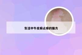 生活中牛皮癣止痒的偏方