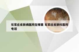 石家庄皮肤病医院在哪里 石家庄皮肤科医院电话