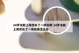 24岁女脸上突然长了一块白斑 24岁女脸上突然长了一块白斑怎么办