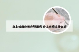 身上长癣吃善存管用吗 身上有癣吃什么好