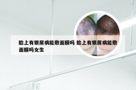 脸上有银屑病能敷面膜吗 脸上有银屑病能敷面膜吗女生