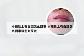 小孩脸上有白斑怎么回事 小孩脸上有白斑怎么回事该怎么艾灸