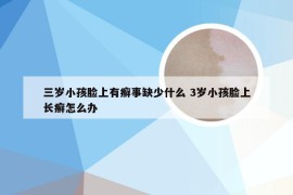 三岁小孩脸上有癣事缺少什么 3岁小孩脸上长癣怎么办