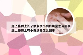 腿上胳膊上长了很多很小的白斑是怎么回事 腿上胳膊上有小白点是怎么回事