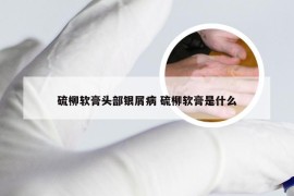 硫柳软膏头部银屑病 硫柳软膏是什么