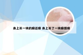 身上长一块的癣还痒 身上长了一块癣很痒