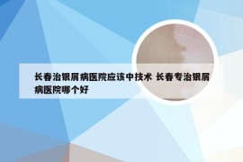 长春治银屑病医院应该中技术 长春专治银屑病医院哪个好