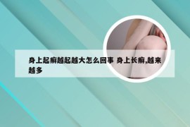 身上起癣越起越大怎么回事 身上长癣,越来越多